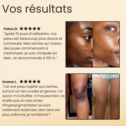 Savon Anti-Taches - Curma (100g)